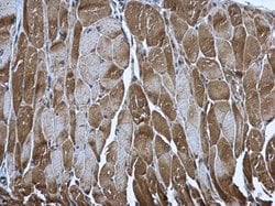 Invitrogen PUS1 Polyclonal Antibody 100 &mu;L; Unconjugated:Antibodies,