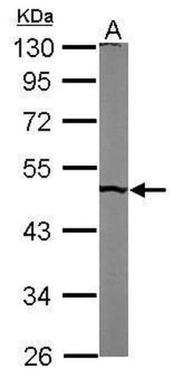 Invitrogen PUS1 Polyclonal Antibody 100 &mu;L; Unconjugated:Antibodies,