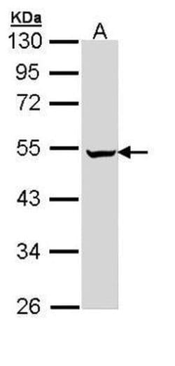 Invitrogen PUS1 Polyclonal Antibody 100 &mu;L; Unconjugated:Antibodies,