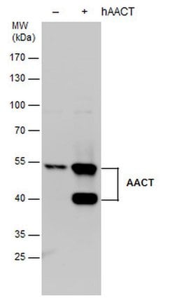 Invitrogen SERPINA3 Polyclonal Antibody 100 &mu;L; Unconjugated:Antibodies,