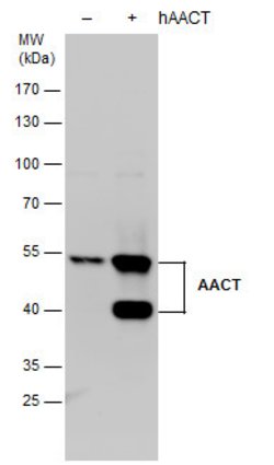 Invitrogen SERPINA3 Polyclonal Antibody 100 &mu;L; Unconjugated:Antibodies,