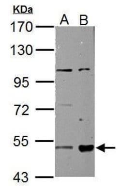 Invitrogen ALDH3A2 Polyclonal Antibody 100 &mu;L; Unconjugated:Antibodies,