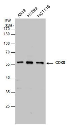 Invitrogen CDK8 Polyclonal Antibody 100 &mu;L; Unconjugated:Antibodies,