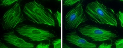 Invitrogen beta Actin Polyclonal Antibody 100 &mu;L; Unconjugated:Antibodies,