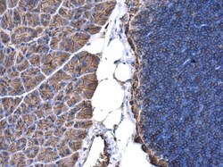 Invitrogen beta Actin Polyclonal Antibody 100 &mu;L; Unconjugated:Antibodies,