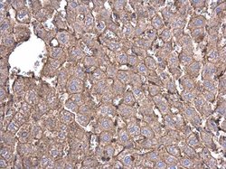 Invitrogen beta Actin Polyclonal Antibody 100 &mu;L; Unconjugated:Antibodies,