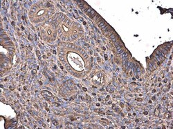 Invitrogen beta Actin Polyclonal Antibody 100 &mu;L; Unconjugated:Antibodies,