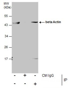 Invitrogen beta Actin Polyclonal Antibody 100 &mu;L | Buy Online | Invitrogen&trade; | Fisher Scientific