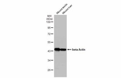 Invitrogen beta Actin Polyclonal Antibody 100 &mu;L; Unconjugated:Antibodies,