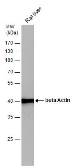 Invitrogen beta Actin Polyclonal Antibody 100 &mu;L; Unconjugated:Antibodies,
