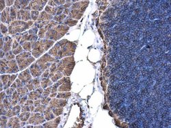 Invitrogen beta Actin Polyclonal Antibody 100 &mu;L; Unconjugated:Antibodies,