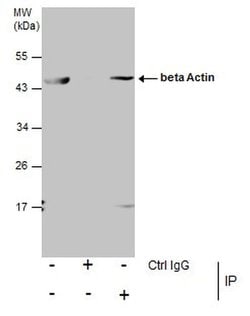 Invitrogen beta Actin Polyclonal Antibody 100 &mu;L; Unconjugated:Antibodies,