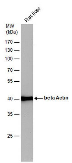 Invitrogen beta Actin Polyclonal Antibody 100 &mu;L; Unconjugated:Antibodies,