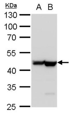 Invitrogen beta Actin Polyclonal Antibody 100 &mu;L; Unconjugated:Antibodies,