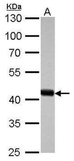 Invitrogen beta Actin Polyclonal Antibody 100 &mu;L; Unconjugated:Antibodies,