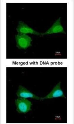 Invitrogen NFkB p105 Polyclonal Antibody 100 &mu;L | Buy Online | Invitrogen&trade; | Fisher Scientific