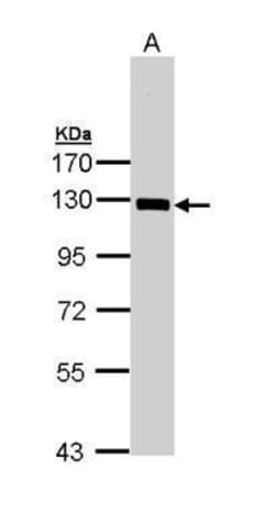 Invitrogen NFkB p105 Polyclonal Antibody 100 &mu;L | Buy Online | Invitrogen&trade; | Fisher Scientific