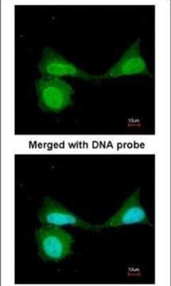 Invitrogen NFkB p105 Polyclonal Antibody 100 &mu;L; Unconjugated:Antibodies,