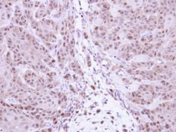 Invitrogen NFkB p105 Polyclonal Antibody 100 &mu;L; Unconjugated:Antibodies,
