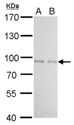 Invitrogen FOXO1 Polyclonal Antibody 100 &mu;L | Buy Online | Invitrogen&trade; | Fisher Scientific
