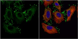 Catenin alpha-1 Polyclonal Antibody, Invitrogen 100 &mu;L; Unconjugated:Antibodies,