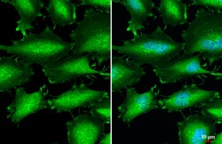 Catenin alpha-1 Polyclonal Antibody, Invitrogen 100 &mu;L; Unconjugated:Antibodies,