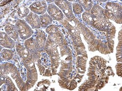 Catenin alpha-1 Polyclonal Antibody, Invitrogen 100 &mu;L; Unconjugated:Antibodies,