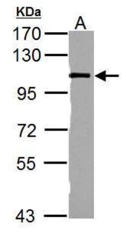 Catenin alpha-1 Polyclonal Antibody, Invitrogen 100 &mu;L; Unconjugated:Antibodies,