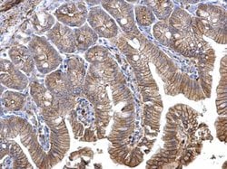 Catenin alpha-1 Polyclonal Antibody, Invitrogen 100 &mu;L; Unconjugated:Antibodies,
