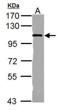 Catenin alpha-1 Polyclonal Antibody, Invitrogen 100 &mu;L; Unconjugated:Antibodies,