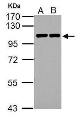 Catenin alpha-1 Polyclonal Antibody, Invitrogen 100 &mu;L; Unconjugated:Antibodies,