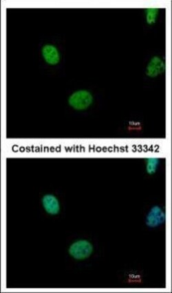Invitrogen ATM Polyclonal Antibody 100 &mu;L; Unconjugated:Antibodies,