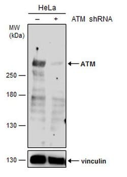 Invitrogen ATM Polyclonal Antibody 100 &mu;L; Unconjugated:Antibodies,