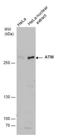 Invitrogen ATM Polyclonal Antibody 100 &mu;L; Unconjugated:Antibodies,