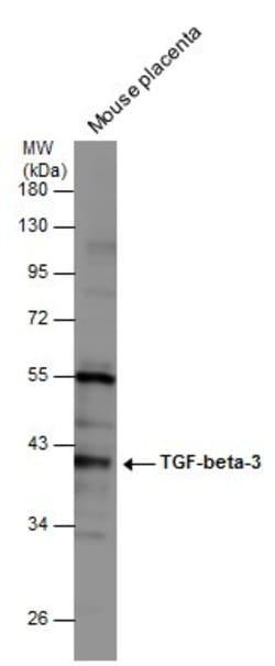 Invitrogen TGF beta-3 Polyclonal Antibody 100 &mu;L; Unconjugated:Antibodies,