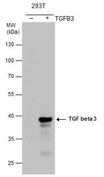 TGF beta-3 Polyclonal Antibody, Invitrogen™