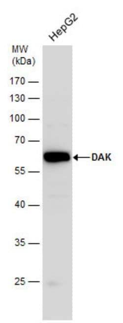 Invitrogen DAK Polyclonal Antibody 100 &mu;L | Buy Online | Invitrogen&trade; | Fisher Scientific