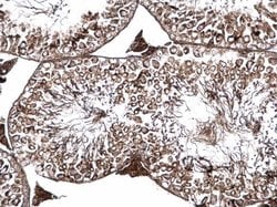 Invitrogen PSKH1 Polyclonal Antibody 100 &mu;L; Unconjugated:Antibodies,