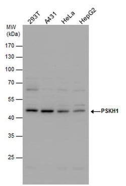 Invitrogen PSKH1 Polyclonal Antibody 100 &mu;L; Unconjugated:Antibodies,