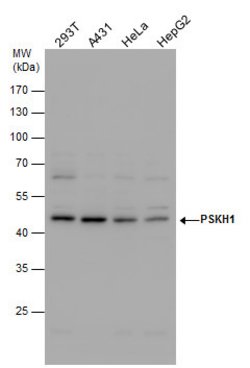 Invitrogen PSKH1 Polyclonal Antibody 100 &mu;L; Unconjugated:Antibodies,