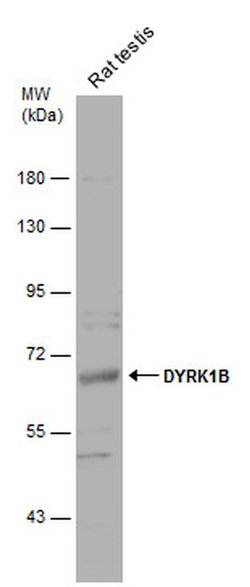 Invitrogen DYRK1B Polyclonal Antibody 100 &mu;L; Unconjugated:Antibodies,