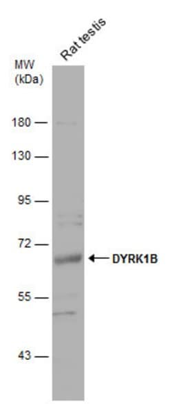 Invitrogen DYRK1B Polyclonal Antibody 100 &mu;L; Unconjugated:Antibodies,