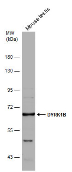 Invitrogen DYRK1B Polyclonal Antibody 100 &mu;L; Unconjugated:Antibodies,