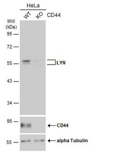 Invitrogen Lyn Polyclonal Antibody 100 &mu;L; Unconjugated:Antibodies,