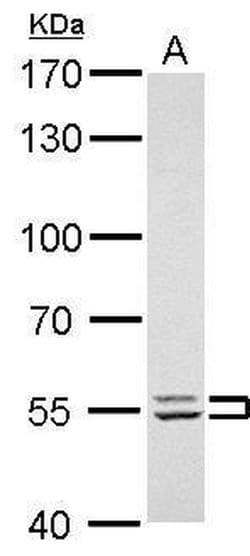 Invitrogen Lyn Polyclonal Antibody 100 &mu;L; Unconjugated:Antibodies,