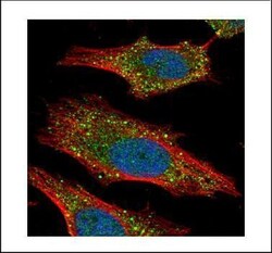 Invitrogen AKT2 Polyclonal Antibody 100 &mu;L; Unconjugated:Antibodies,