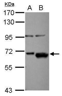 Invitrogen AKT2 Polyclonal Antibody 100 &mu;L; Unconjugated:Antibodies,