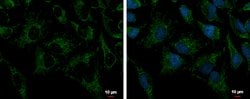 Invitrogen PRDX3 Polyclonal Antibody 100 &mu;L; Unconjugated:Antibodies,