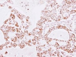 Invitrogen PRDX3 Polyclonal Antibody 100 &mu;L; Unconjugated:Antibodies,