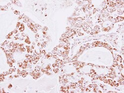 Invitrogen PRDX3 Polyclonal Antibody 100 &mu;L; Unconjugated:Antibodies,